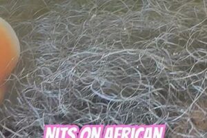 Unveiling Nits in African American Hair: Discoveries and Insights Unraveled | Africa Unveiled: Nature, Culture, and History