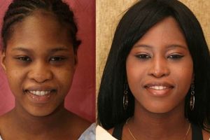 Uncover the Secrets: African American Nose Jobs Before and After Africa Unveiled: Nature, Culture, and History Uncover the Secrets: African American Nose Jobs Before and After | Africa Unveiled: Nature, Culture, and History