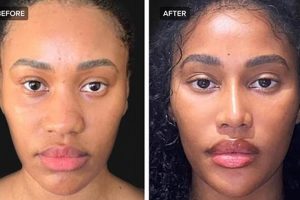 Discover the True Cost of African American Rhinoplasty: Insights Unveiled Africa Unveiled: Nature, Culture, and History Discover the True Cost of African American Rhinoplasty: Insights Unveiled | Africa Unveiled: Nature, Culture, and History