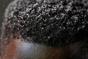 Discover Revolutionary Insights: Combating Dandruff on African American Hair Africa Unveiled: Nature, Culture, and History Discover Revolutionary Insights: Combating Dandruff on African American Hair | Africa Unveiled: Nature, Culture, and History